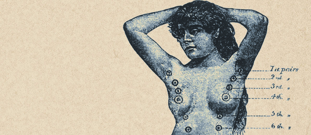 A topless woman with her hands behind her head with six pairs of nipples